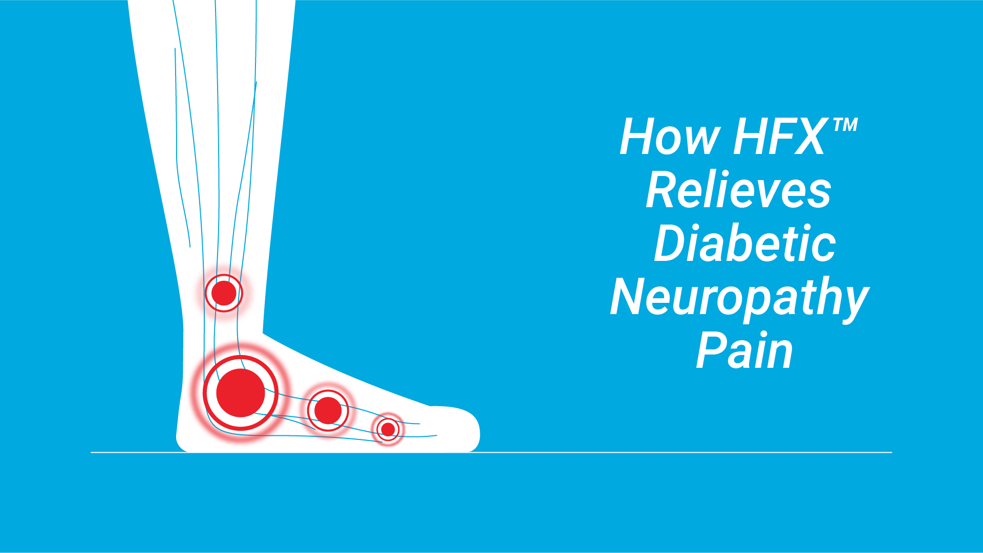 https://dev.hfxforpdn.staging.poundandgrain.ca/app/uploads/2025/02/Video-Thumbnail-HowHFXRelievesDiabeticNeuropathyPain.png